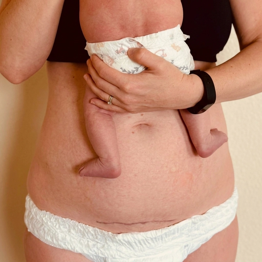 The Automatic Order Set: A New Blueprint for the Future of Pelvic Health